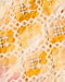 Enthralling Rani Yellow Kurta Jacket Set